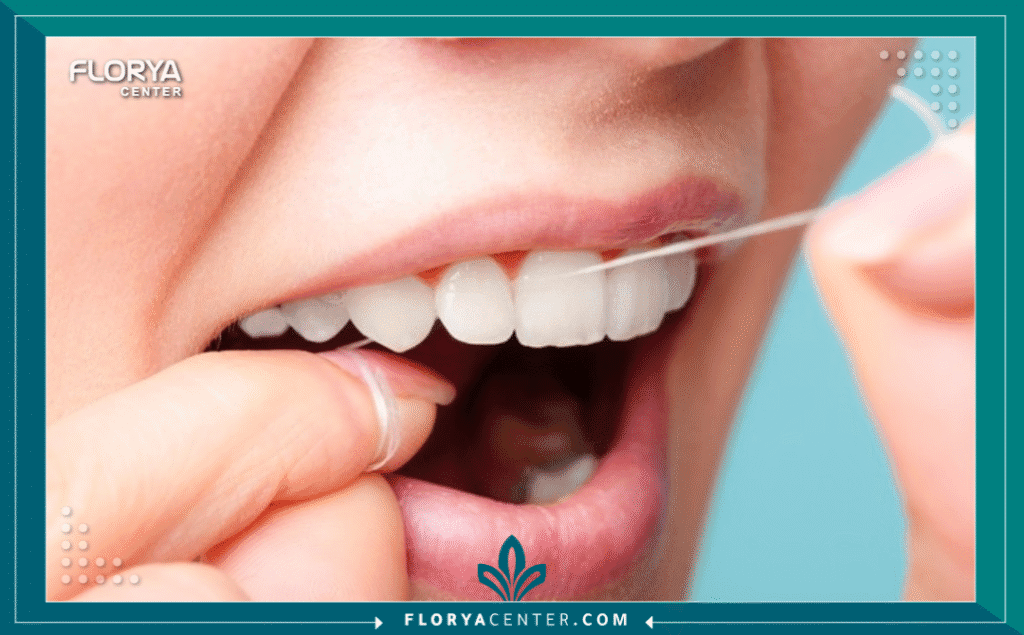 nouralagee93@gmail.com 20250906 132013 ٠٠٠٠ - أهمية استخدام خيط الأسنان تكمن أهمية استخدام خيط الأسنان في كونه خط الدفاع الأول ضد مشاكل الفم الأكثر تعقيداً، والتي تبدأ غالباً من المناطق التي تعجز فرشاة الأسنان عن الوصول إليها. يعتقد الكثيرون أن تنظيف الأسنان بالفرشاة مرتين يومياً كافٍ، لكن الحقيقة الطبية، كما تؤكدها الجمعية الأمريكية لطب الأسنان (ADA)، هي أن الفرشاة تنظف حوالي 60% فقط من أسطح الأسنان. الـ 40% المتبقية، وهي المناطق البينية (بين الأسنان) وتحت خط اللثة، تصبح مرتعاً للبكتيريا. إن إدراك أهمية استخدام خيط الأسنان ليس رفاهية، بل هو ضرورة أساسية لإكمال عملية التنظيف ومنع أمراض اللثة والتسوس البيني، وهو ما نعتبره في "مركز فلوريا" الركيزة الأساسية لصحة الفم المستدامة. إن عملية تنظيف الأسنان بالخيط (Dental Flossing) هي الإجراء الوقائي الأدق والأكثر فعالية.