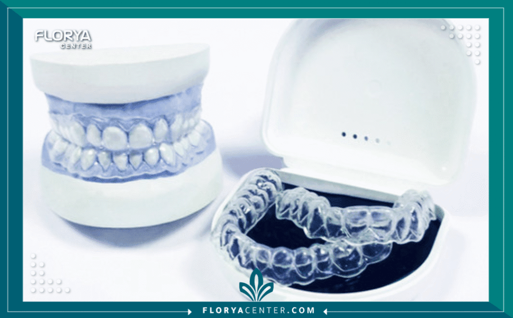 nouralagee93@gmail.com 20250908 075042 ٠٠٠٠ - قوالب تبييض الأسنان المنزلية تُعد قوالب تبييض الأسنان المنزلية (Home Teeth Whitening Trays) واحدة من أكثر الحلول فعالية وشعبية لاستعادة الابتسامة البيضاء الناصعة، وهي تمثل حلاً وسطاً مثالياً يجمع بين الراحة المنزلية والنتائج الاحترافية. مع تزايد الطلب على الإجراءات التجميلية للأسنان، يبرز هذا الخيار كبديل عملي لتبييض الليزر المكلف في العيادات.