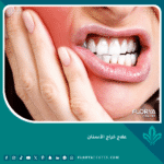 علاج خراج الأسنان في المنزل