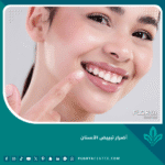 أضرار تبييض الأسنان