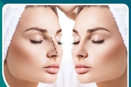 أفضل دكتور تجميل أنف في تركيا