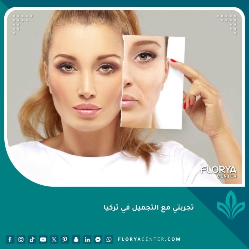 تجربتي مع التجميل في تركيا