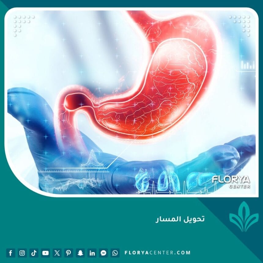 تحويل المسار