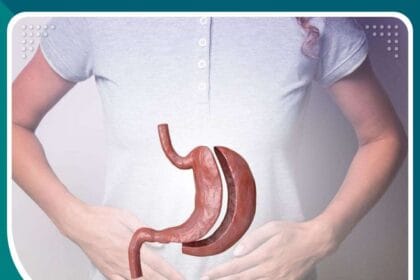 مخاطر عملية تكميم المعدة