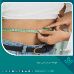 جراحة السمنة في تركيا