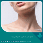 أفضل طبيب شد الرقبة بالخيوط في تركيا