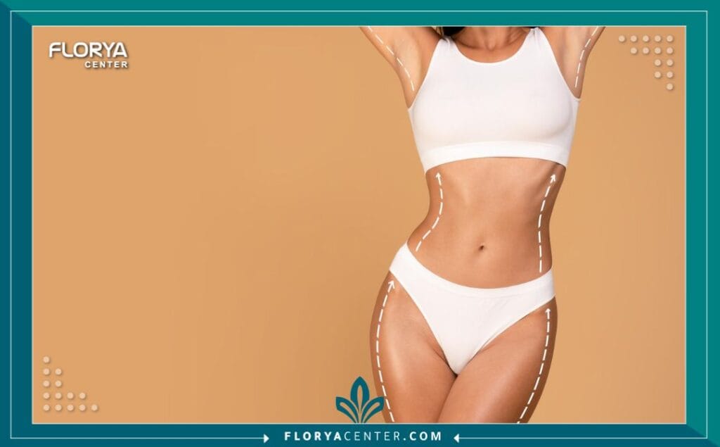 تكلفة نحت الجسم في تركيا 1 - تكلفة نحت الجسم في تركيا تكلفة نحت الجسم في تركيا (Body Contouring Cost in Turkey) هي أول ما يتبادر إلى ذهنك عند التفكير في صقل قوامك والتخلص من الدهون العنيدة. أنت لست وحدك. الملايين يبحثون عن حل جذري يجمع بين الجودة العالية والسعر المنطقي، وهنا تبرز تركيا كوجهة أولى عالمياً. لكن رحلة البحث عن تكلفة نحت الجسم في تركيا قد تكون محفوفة بالارتباك؛ أرقام متفاوتة، وعود براقة، ومراكز لا حصر لها.