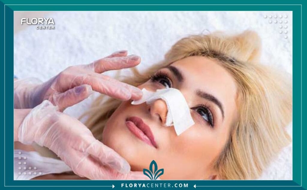 الصور داخل المقالة مها 2025 11 15T235653.868 - تجميل الأنف العريض في تركيا يُعد تجميل الأنف العريض في تركيا اليوم أحد أكثر الإجراءات الجراحية التجميلية دقة وطلباً، وهو لا يمثل مجرد رفاهية، بل هو خطوة فنية نحو استعادة التناسق المثالي لملامح الوجه. إن السعي للحصول على أنف متناغم مع بقية ملامح الوجه هو رغبة مشتركة، خاصة عندما يكون عرض الأنف – سواء في الجسر أو الطرف – هو السمة الغالبة التي قد تؤثر على التوازن الجمالي العام. هذا الإجراء، المعروف علمياً باسم (Wide Nose Rhinoplasty)، يتطلب خبرة جراحية فائقة وفهماً عميقاً للتشريح العرقي والفردي لكل مريض، وهو ما برعت فيه المراكز المتقدمة في اسطنبول.