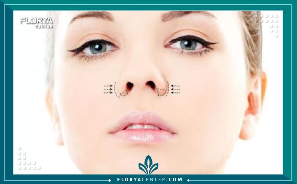 تجميل أرنبة الأنف في تركيا 2 الصور داخل المقالة مها 2025 11 16T042742.443 - تجميل أرنبة الأنف في تركيا يُعد البحث عن تجميل أرنبة الأنف في تركيا (Tip Rhinoplasty) خطوة أولى نحو تحقيق توازن دقيق في ملامح الوجه، وهو إجراء يركز حصرياً على قمة الأنف دون المساس بالعظم. في عالم اليوم، لم تعد الجراحة التجميلية مجرد رفاهية، بل هي وسيلة لاستعادة الثقة بالنفس عبر تحسينات دقيقة تتناغم مع الشكل الطبيعي للوجه. وتبرز تركيا، وخاصة اسطنبول، كعاصمة عالمية لهذا النوع من الجراحات الدقيقة، جامعةً بين الخبرة الفائقة والتكاليف المدروسة.