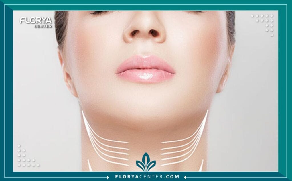 الصور داخل المقالة مها 2025 11 20T013301.625 - شد الرقبة في تركيا أصبحت شد الرقبة في تركيا (Neck Lift) اليوم واحدة من أكثر الوجهات والخيارات العلاجية جذباً للآلاف من الراغبين في استعادة مظهر الشباب والحيوية. إن عملية شد الرقبة في تركيا لا تقتصر فقط على كونها إجراءً تجميلياً، بل هي رحلة متكاملة نحو تعزيز الثقة بالنفس والتخلص من علامات التقدم في السن التي تظهر بوضوح في منطقة الرقبة والفكين. يختار المرضى من مختلف أنحاء العالم إجراء شد الرقبة في تركيا نظراً للجمع الفريد بين الخبرة الطبية العالية، والتقنيات المتطورة، والأسعار التنافسية التي لا تضاهى في أوروبا أو الولايات المتحدة.
