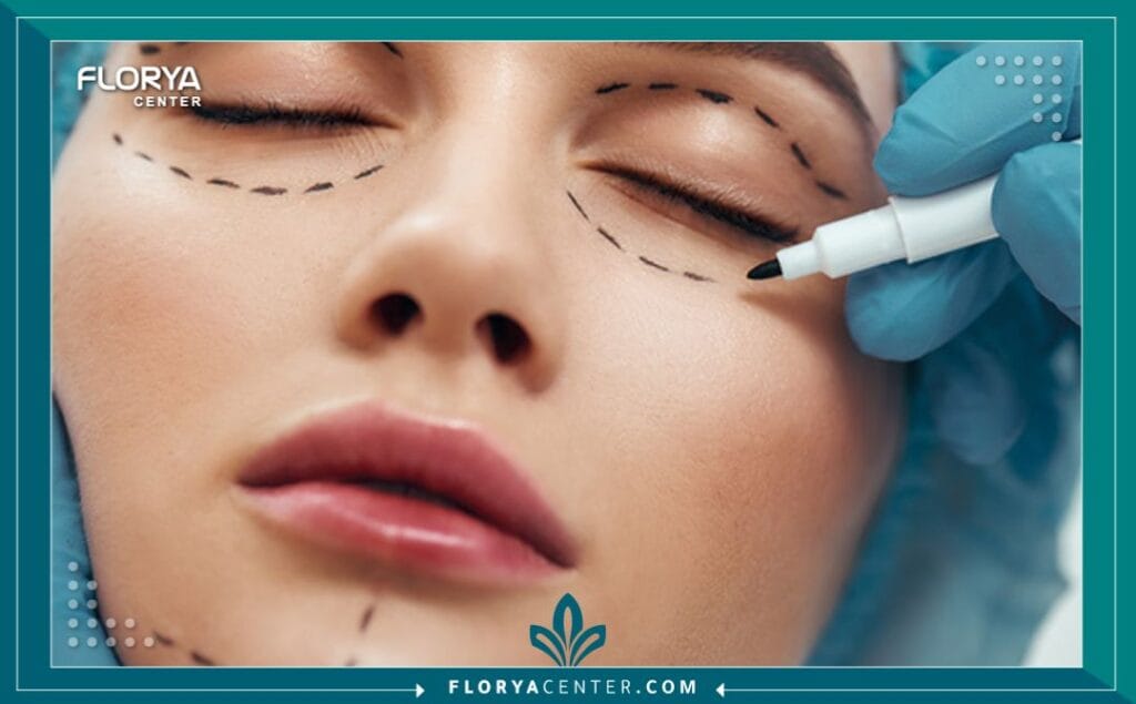 الصور داخل المقالة مها 2025 11 21T154333.613 - شد الجفون السفلية في تركيا هل تشعر أن عينيك تروي قصة تعب وإرهاق لم تعشه حقاً؟ إن عملية شد الجفون السفلية في تركيا (Lower Eyelid Blepharoplasty in Turkey) ليست مجرد إجراء تجميلي عابر، بل هي بوابتك الذهبية لاستعادة بريق الشباب المفقود ومحو سنوات من الإجهاد البادي على وجهك. في عالم اليوم، حيث الانطباع الأول هو كل شيء، باتت العيون المتعبة والجيوب المنتفخة عائقاً أمام الثقة بالنفس، مما يجعل البحث عن الحل الأمثل ضرورة وليس ترفاً. إن اختيارك لإجراء شد الجفون السفلية في تركيا يضعك في قلب عاصمة التجميل العالمية، حيث تجتمع الخبرة الطبية العريقة مع التقنيات الثورية لتمنحك نتائج طبيعية ومذهلة.