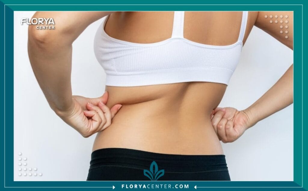 الصور داخل المقالة مها 21 - شفط دهون الظهر في تركيا يُعتبر شفط دهون الظهر في تركيا أحد أكثر الإجراءات التجميلية طلباً لأولئك الذين يسعون للحصول على قوام متناسق ومنحوت. غالباً ما يكون الظهر، بمناطقه المختلفة (العليا، الوسطى، والسفلى)، من أكثر الأماكن في الجسم مقاومةً للتمارين الرياضية الصارمة والحميات الغذائية المنضبطة. هذه الرواسب الدهنية العنيدة يمكن أن تسبب إزعاجاً كبيراً، وتؤثر على كيفية تناسق الملابس، وتخلق مظهراً غير متجانس يُعرف بـ "لفائف حمالة الصدر" (Bra Rolls) أو تكتلات عند منطقة الخصر.