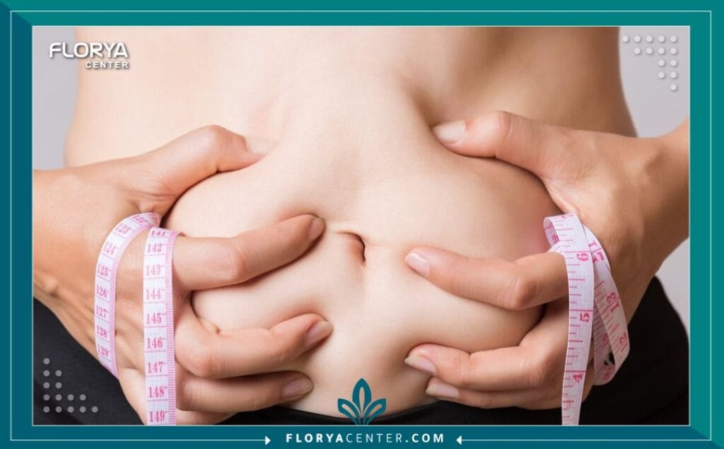 الصور داخل المقالة مها 74 - شد عضلات البطن في تركيا ​يُعد إجراء شد عضلات البطن في تركيا (Abdominoplasty) واحداً من أكثر الحلول الجراحية فعالية لاستعادة مظهر بطن مسطح ومشدود. مع التغيرات الكبيرة التي قد تطرأ على الجسم بسبب الحمل، أو فقدان الوزن الكبير، أو حتى التقدم الطبيعي في السن، قد تصبح عضلات البطن ضعيفة ويترهل الجلد، مما يسبب إزعاجاً جمالياً ونفسياً للكثيرين. تهدف هذه الجراحة إلى معالجة هذه التغيرات، وإزالة الجلد الزائد والدهون، وإصلاح العضلات المنفصلة، مما يمنحك القوام المتناسق الذي تطمح إليه ويعزز ثقتك بنفسك.