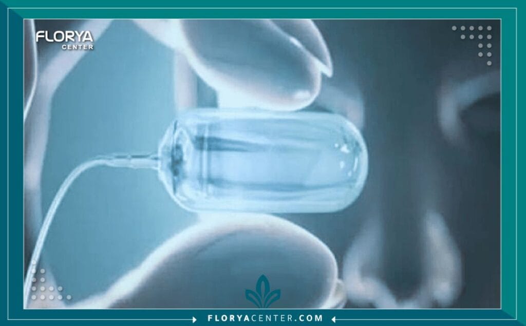 الكبسولة الذكية في تركيا