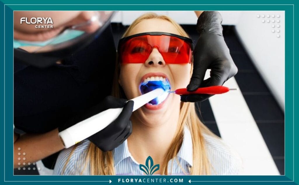 تبييض الأسنان بالليزر في تركيا