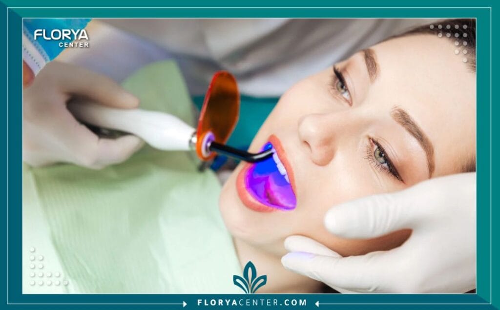 تبييض الأسنان بالليزر في تركيا