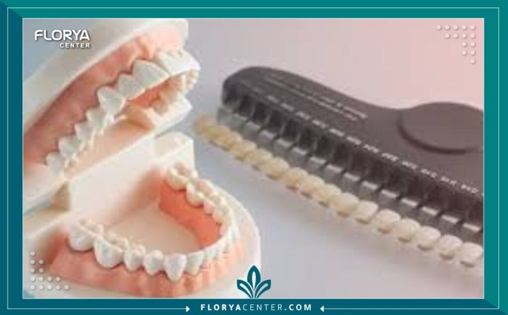 تركيبات الأسنان في تركيا