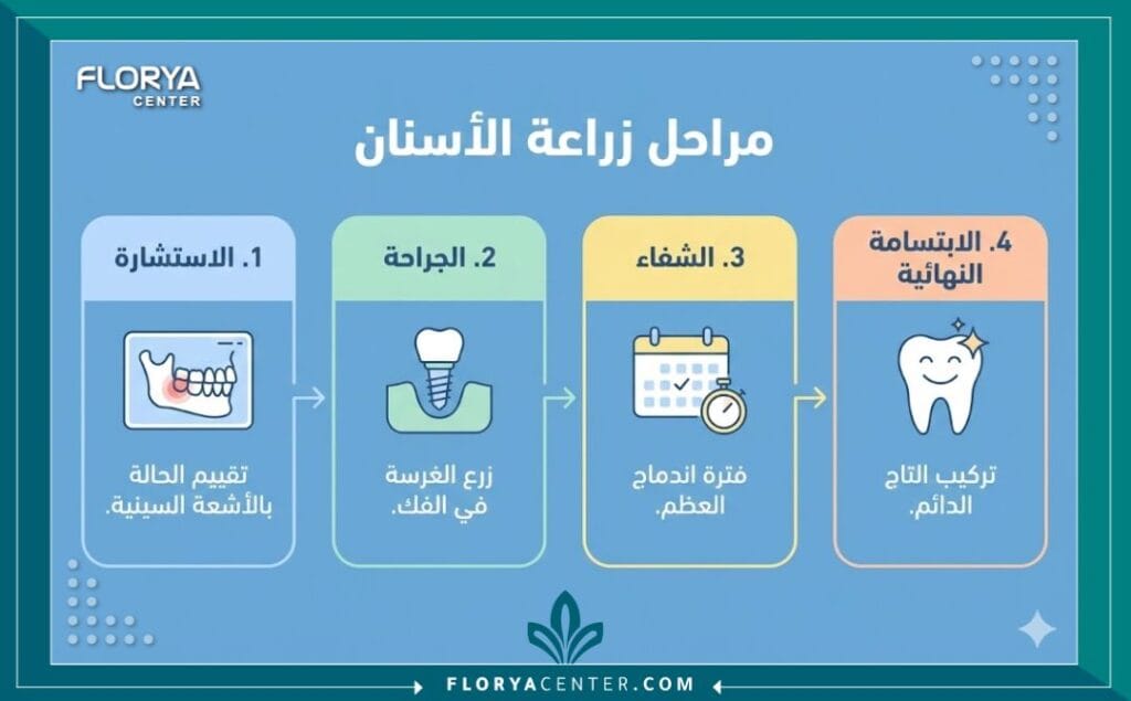 إنفوجرافيك يوضح خطوات زراعة الأسنان في تركيا والمراحل الزمنية للعلاج من الكشف وحتى التركيب النهائي.
