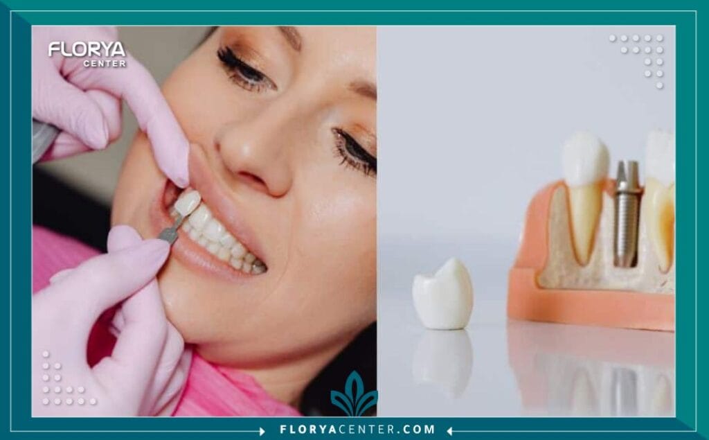 زراعة الأسنان في تركيا