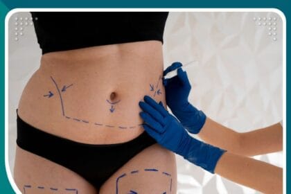 أنواع عمليات التجميل المتعلقة بالسمنة