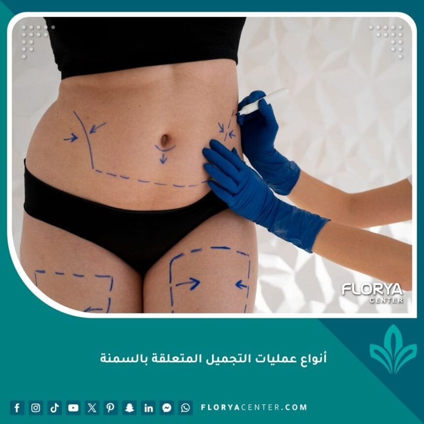 أنواع عمليات التجميل المتعلقة بالسمنة
