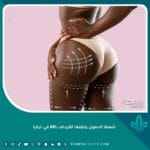 شفط الدهون ونقلها للأرداف BBL في تركيا