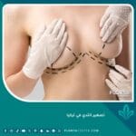 تصغير الثدي في تركيا