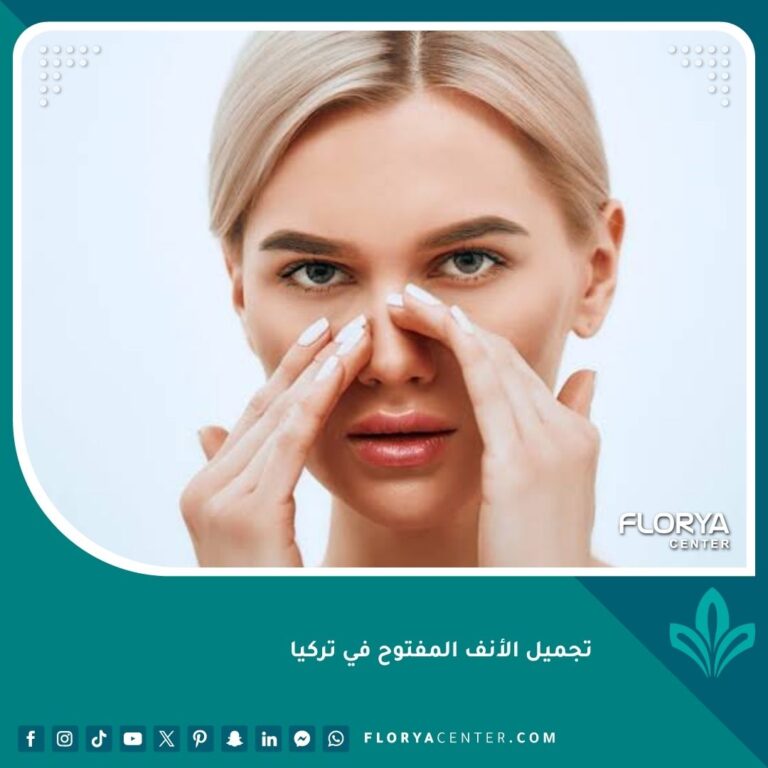 تجميل الأنف المفتوح في تركيا