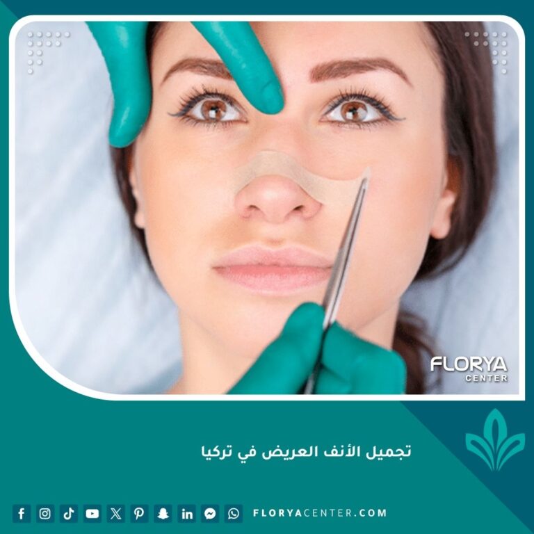 تجميل الأنف العريض في تركيا