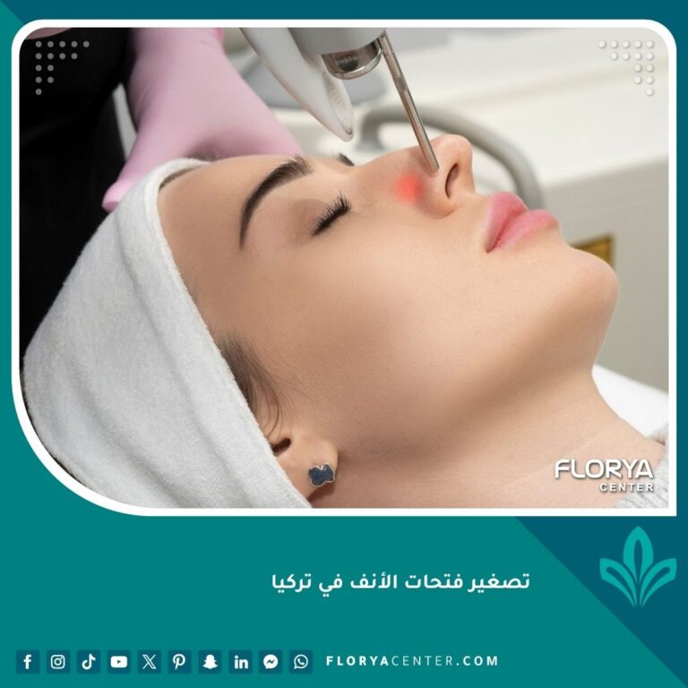 تصغير فتحات الأنف في تركيا