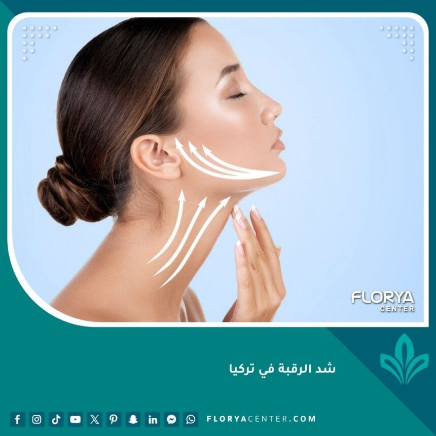 شد الرقبة في تركيا