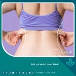 شفط دهون الظهر في تركيا