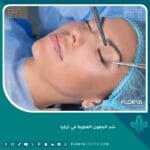 شد الجفون العلوية في تركيا