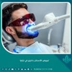 تبييض الأسنان بالليزر في تركيا