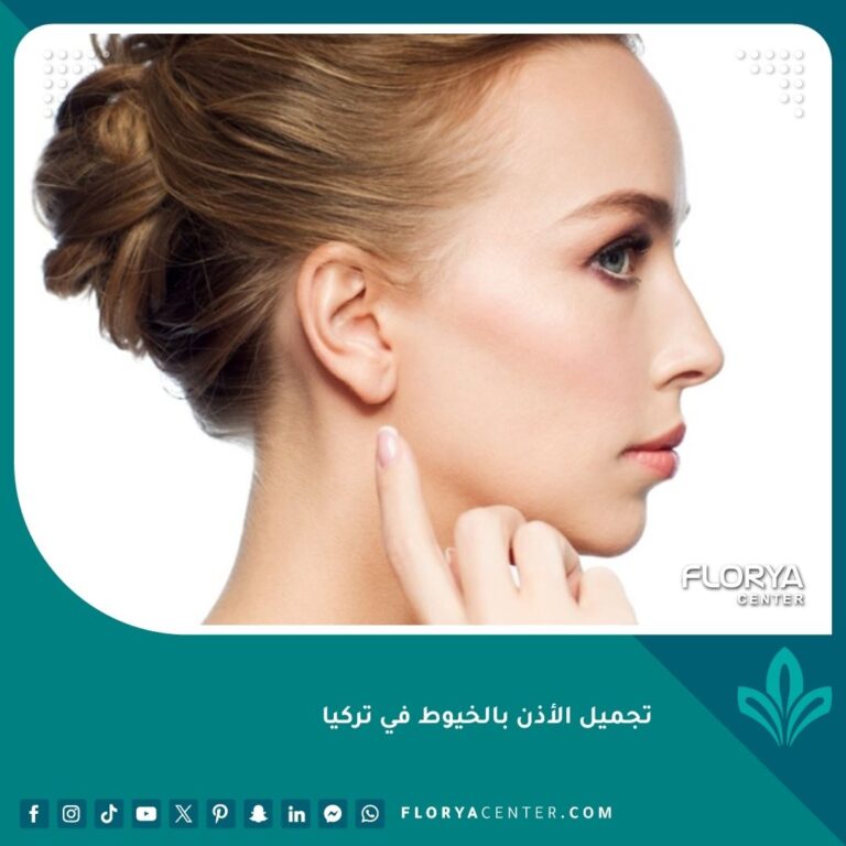 تجميل الأذن بالخيوط في تركيا