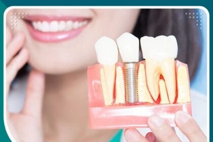 زراعة الأسنان في تركيا