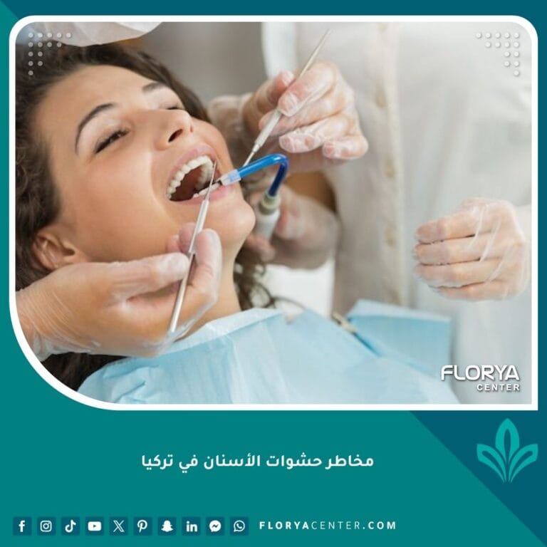 مخاطر حشوات الأسنان في تركيا