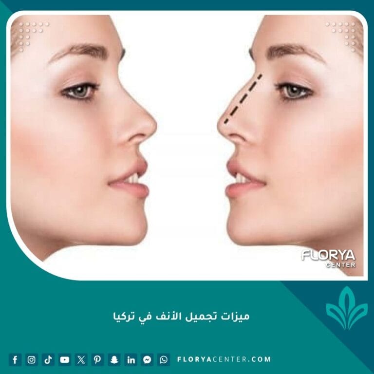 ميزات تجميل الأنف في تركيا