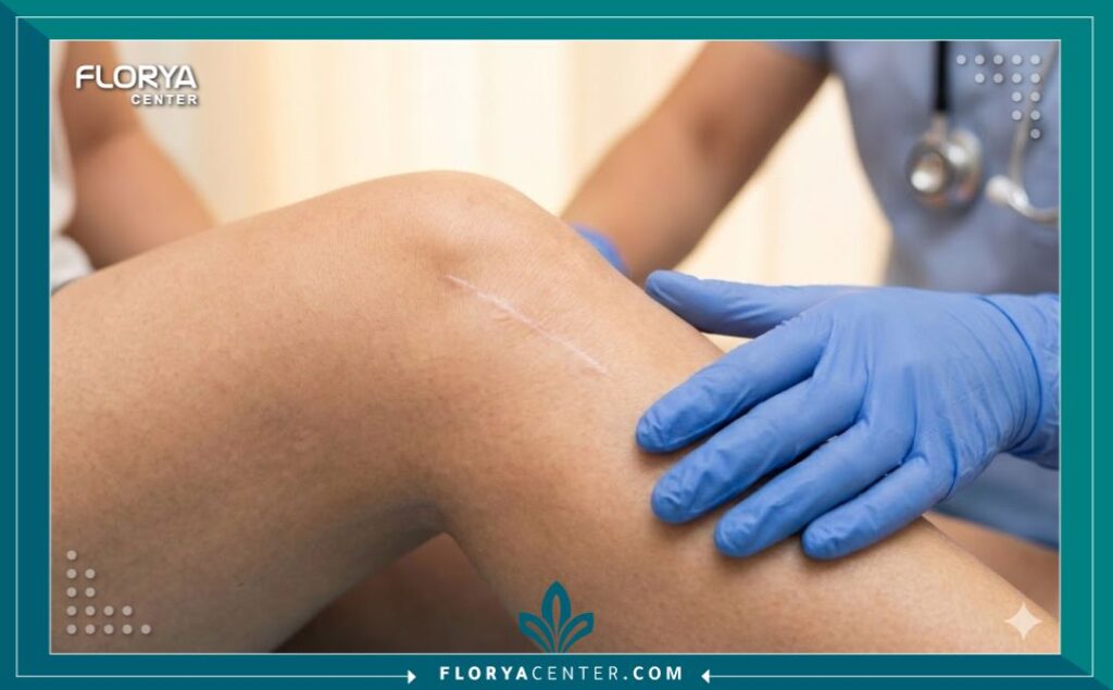 فحص طبي بعد عملية إزالة المسامير من الساق في مركز متخصص بتركيا.