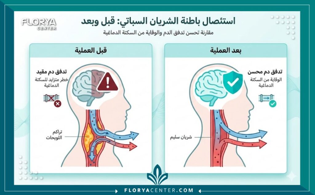 إنفوجرافيك يوضح فوائد عملية جراحة الشريان السباتي تركيا ونسب النجاح في المراكز الطبية التركية.