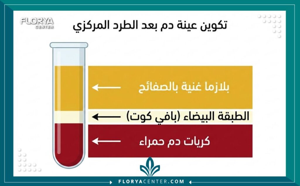 مخطط توضيحي لمكونات الدم بعد الفصل في جهاز الطرد المركزي لاستخلاص البلازما.