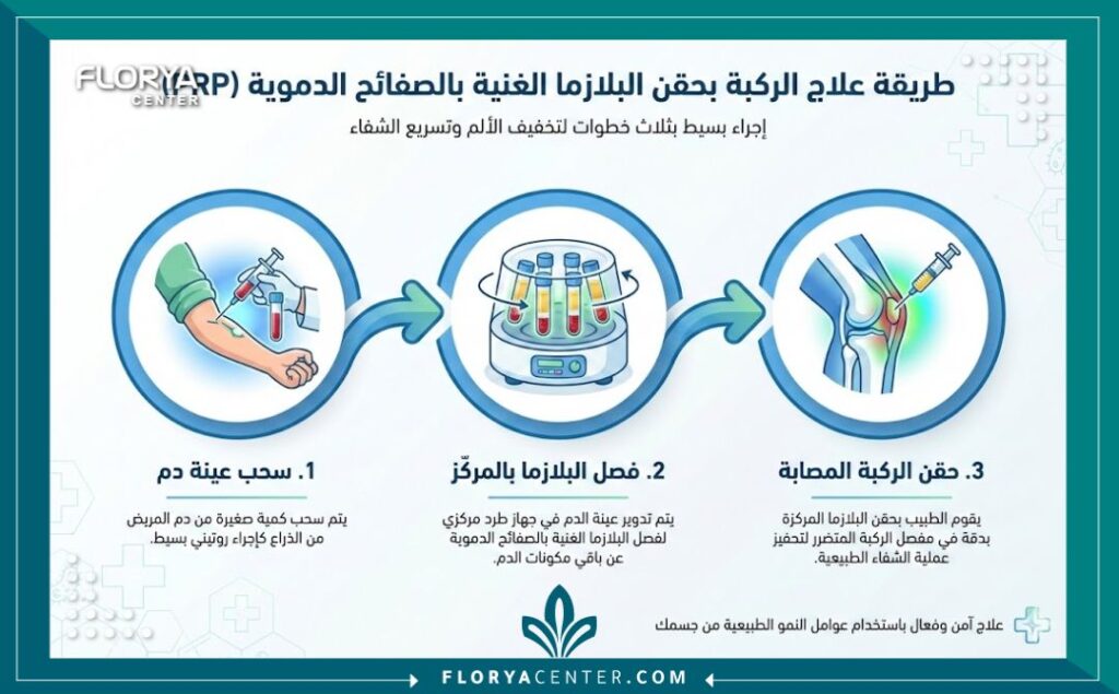 حقن البلازما للركبة (PRP) 3 إنفوجرافيك يوضح خطوات عملية حقن البلازما للركبة: بدءاً من سحب الدم، ثم فصل البلازما باستخدام جهاز الطرد المركزي، وأخيراً حقنها في مفصل الركبة.