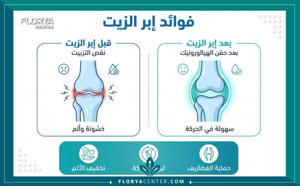 إنفوجرافيك يوضح فوائد حقن الهيالورونيك (إبر الزيت) للمفاصل في تحسين حركة المفصل وتقليل الاحتكاك.