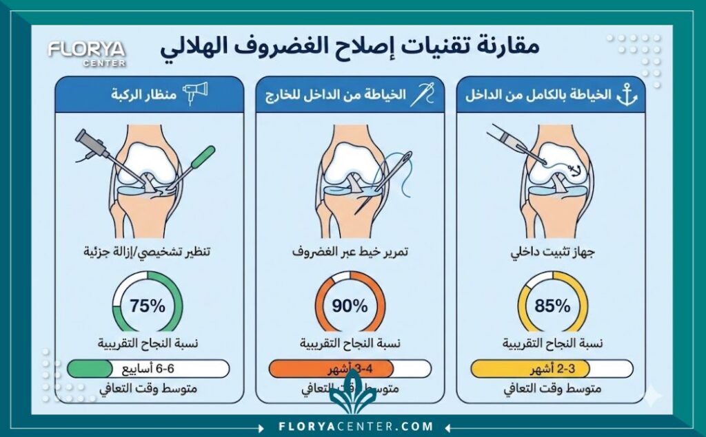 إنفوجرافيك يقارن بين تقنيات خياطة الغضروف الهلالي في تركيا (بالمنظار، من الداخل للخارج، بالكامل من الداخل) ومعدلات نجاحها وفترة التعافي باللغة العربية.