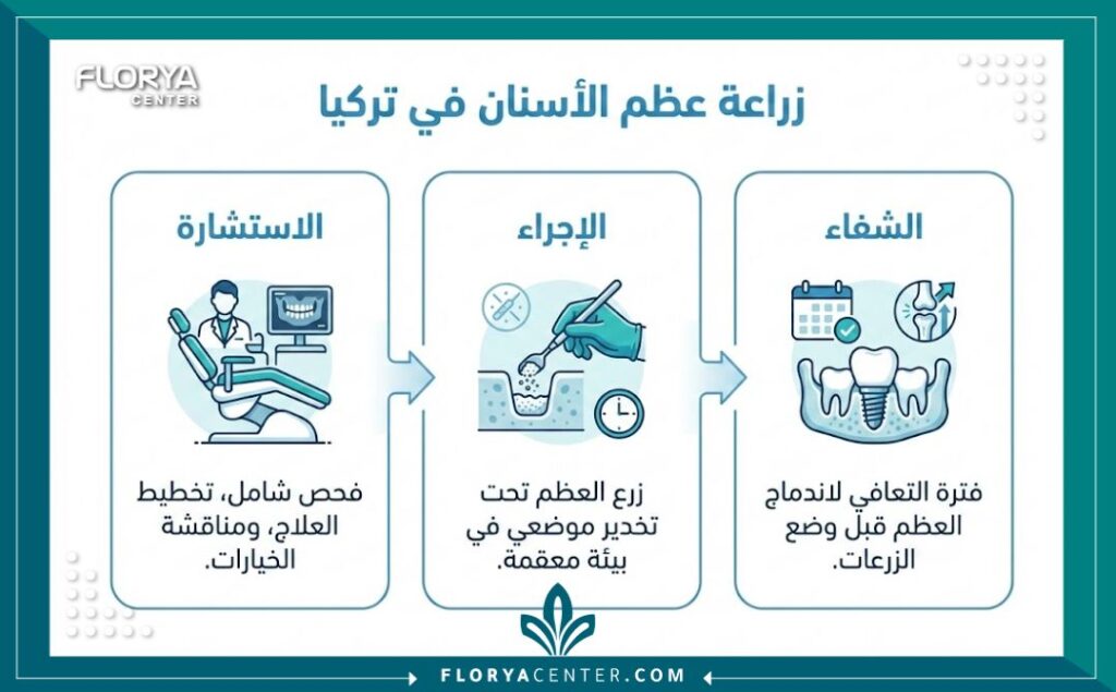 إنفوجرافيك يوضح مراحل وخطوات عملية زراعة عظام الفك في تركيا من الاستشارة وحتى التعافي.