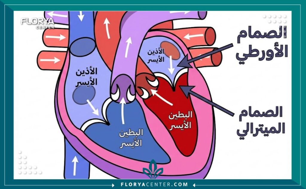 مخطط تشريحي يوضح هيكل صمامات القلب وكيفية عملها قبل إجراء العملية الجراحية.
