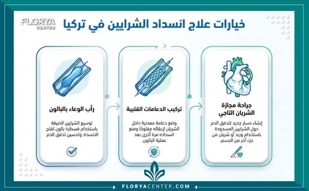 إنفوجرافيك يوضح الخيارات الطبية الرئيسية لعلاج انسداد الشرايين تركيا المتاحة في المستشفيات، بما في ذلك القسطرة، الدعامات، وجراحة القلب المفتوح.