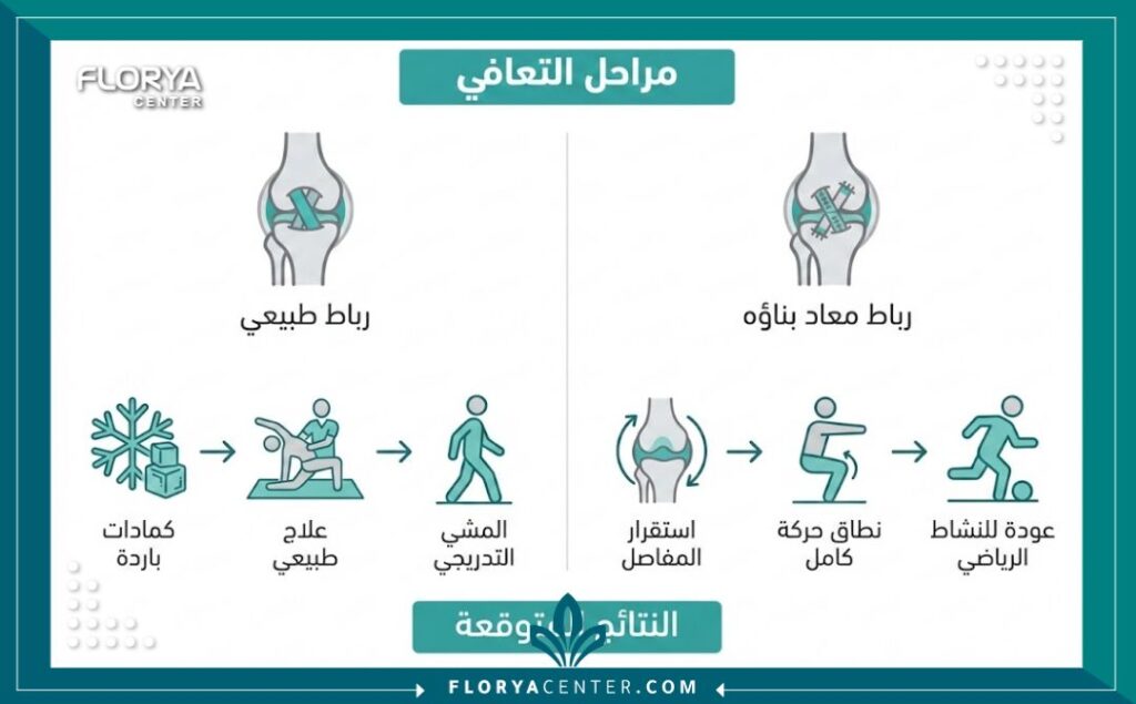 عملية إعادة بناء الرباط الجانبي 3 إنفوجرافيك يوضح مراحل التعافي والنتائج المتوقعة بعد جراحة عملية إعادة بناء الرباط الجانبي.