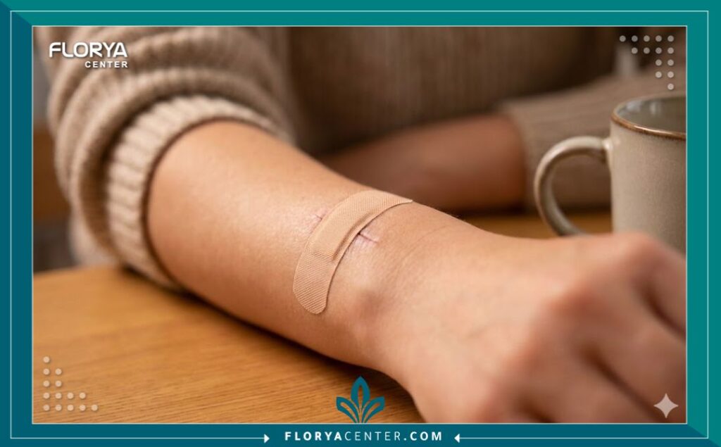 مريض يظهر معصمه بعد عملية استئصال الكيس الزلالي بنجاح مع ضمادة طبية نظيفة.