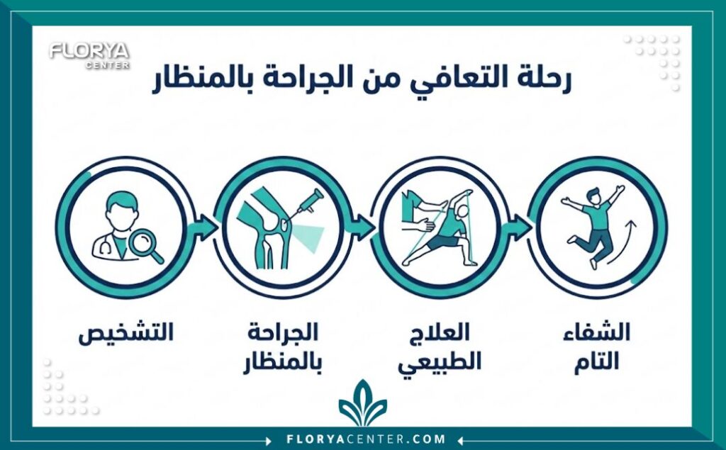 عملية الرباط الصليبي في تركيا 3 إنفوجرافيك يوضح مراحل رحلة علاج وتقنيات عملية الرباط الصليبي في تركيا.